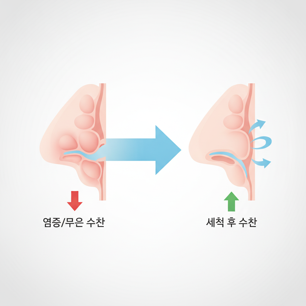 답답한 코, 비강관리키트로 시원하게 관리하는 법 - 비강 구조와 코막힘 원리 설명 그림